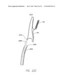 WIRELESS MEMS LEFT ATRIAL PRESSURE SENSOR diagram and image