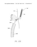 WIRELESS MEMS LEFT ATRIAL PRESSURE SENSOR diagram and image