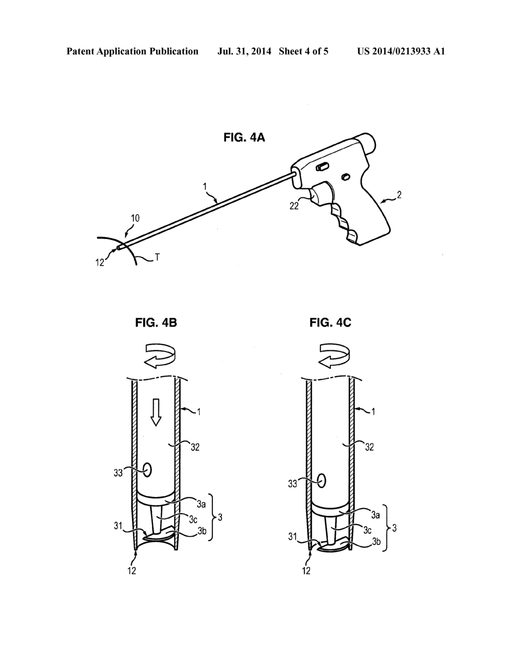 DEVICE FOR THE LAPAROSCOPIC REMOVAL OF A SUPERFICIAL CYLINDRICAL SAMPLE OF     A HUMAN OR ANIMAL BODY TISSUE - diagram, schematic, and image 05