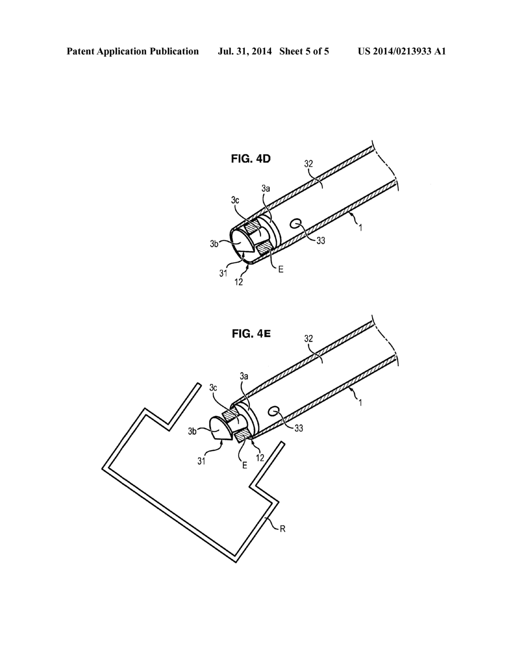 DEVICE FOR THE LAPAROSCOPIC REMOVAL OF A SUPERFICIAL CYLINDRICAL SAMPLE OF     A HUMAN OR ANIMAL BODY TISSUE - diagram, schematic, and image 06