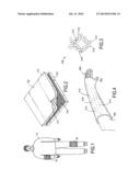 REMOVABLE MEDICAL SUPPORT MECHANISM diagram and image