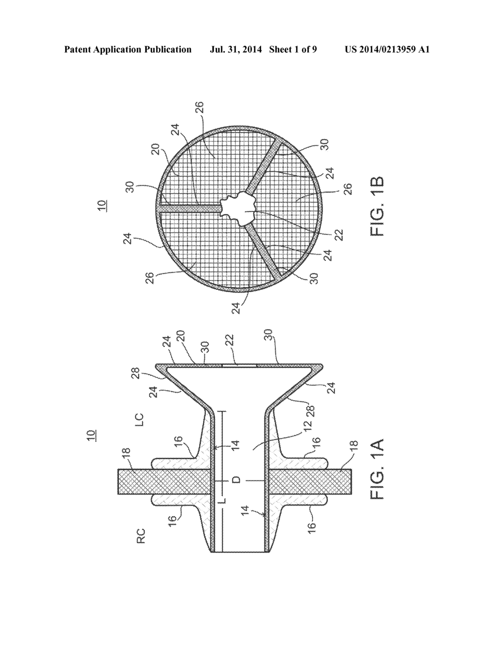 DEVICE AND METHOD FOR REGULATING PRESSURE IN A HEART CHAMBER - diagram, schematic, and image 02