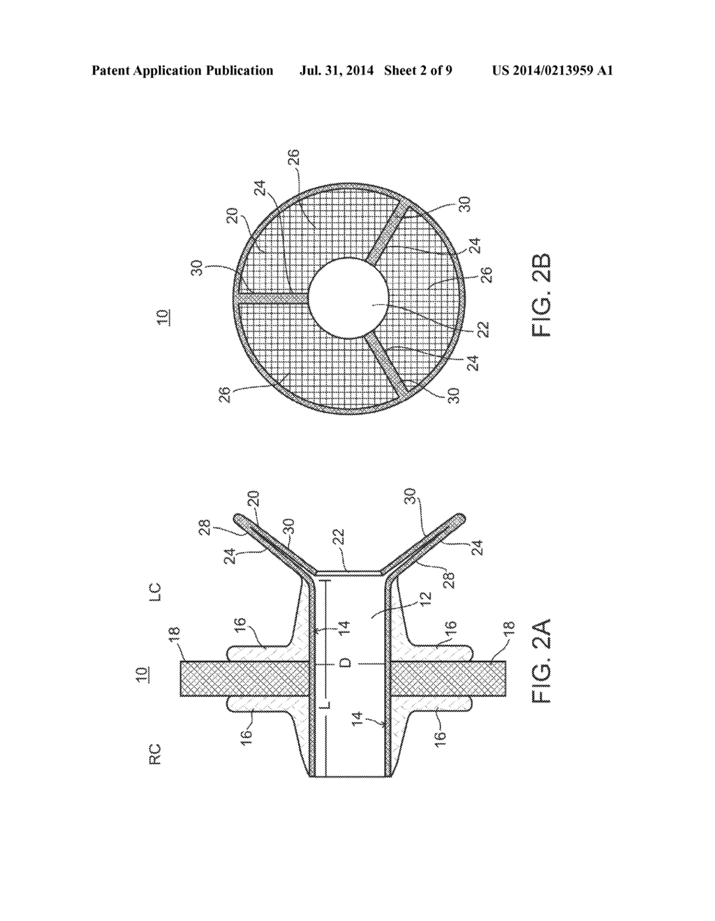 DEVICE AND METHOD FOR REGULATING PRESSURE IN A HEART CHAMBER - diagram, schematic, and image 03