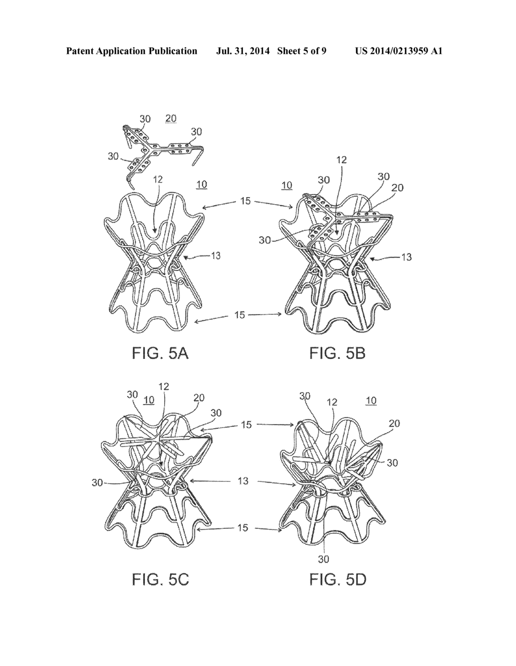 DEVICE AND METHOD FOR REGULATING PRESSURE IN A HEART CHAMBER - diagram, schematic, and image 06