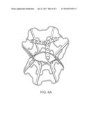 DEVICE AND METHOD FOR REGULATING PRESSURE IN A HEART CHAMBER diagram and image