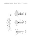 BIT AND SYSTEM FOR FEEDING A VISCOUS AND/OR LIQUID SUBSTANCE INTO THE     MOUTH OF AN ANIMAL diagram and image