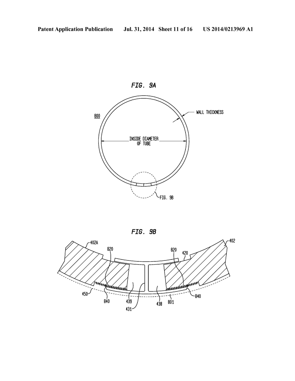 Expandable Inter Vivos Tube - diagram, schematic, and image 12