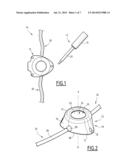 KIT FOR MANEUVERING AN ELEMENT PRESENT IN THE BODY OF A PATIENT,     COMPRISING AN IMPLANTABLE CHAMBER diagram and image