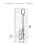 KIT FOR MANEUVERING AN ELEMENT PRESENT IN THE BODY OF A PATIENT,     COMPRISING AN IMPLANTABLE CHAMBER diagram and image