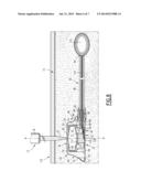KIT FOR MANEUVERING AN ELEMENT PRESENT IN THE BODY OF A PATIENT,     COMPRISING AN IMPLANTABLE CHAMBER diagram and image