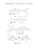 DISPOSABLE ABSORBENT ARTICLE WITH PROFILED ABSORBENT CORE diagram and image