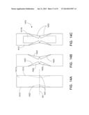 DISPOSABLE ABSORBENT ARTICLE WITH PROFILED ABSORBENT CORE diagram and image