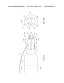 BIFURCATION CATHETER WITH VARIABLE LENGTH OCCLUSION ELEMENTS diagram and image