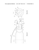 BIFURCATION CATHETER WITH VARIABLE LENGTH OCCLUSION ELEMENTS diagram and image