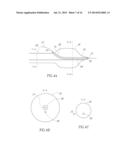 BIFURCATION CATHETER WITH VARIABLE LENGTH OCCLUSION ELEMENTS diagram and image