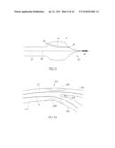 BIFURCATION CATHETER WITH VARIABLE LENGTH OCCLUSION ELEMENTS diagram and image