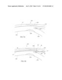 BIFURCATION CATHETER WITH VARIABLE LENGTH OCCLUSION ELEMENTS diagram and image