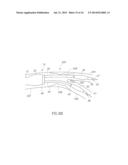 BIFURCATION CATHETER WITH VARIABLE LENGTH OCCLUSION ELEMENTS diagram and image