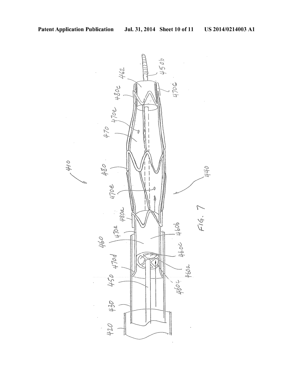 Guidewire and Catheter System and Method for Treating a Blood Clot - diagram, schematic, and image 11