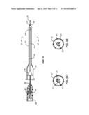 SYSTEMS AND METHODS FOR VENIPUNCTURE AND CATHETER PLACEMENT diagram and image