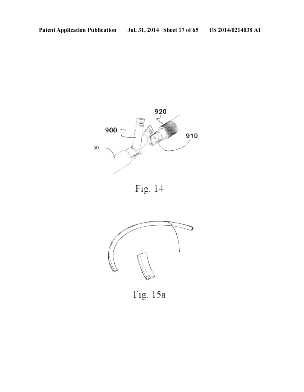 CIRCULAR BONE TUNNELING DEVICE EMPLOYING A STABILIZING ELEMENT - diagram, schematic, and image 18