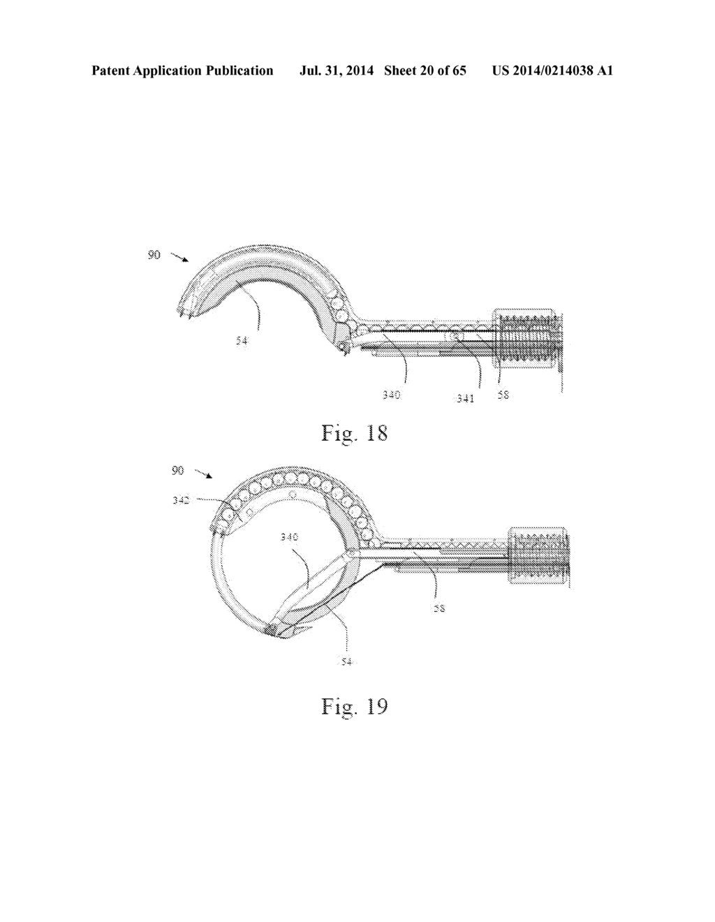 CIRCULAR BONE TUNNELING DEVICE EMPLOYING A STABILIZING ELEMENT - diagram, schematic, and image 21