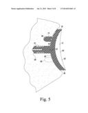 ORTHOPAEDIC SURGICAL SAW ASSEMBLY FOR REMOVING AN IMPLANTED GLENOID     COMPONENT AND METHOD OF USING THE SAME diagram and image