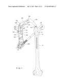 AIMING INSTRUMENT diagram and image