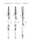 Spring Assisted Medical Device Deployment Assembly diagram and image