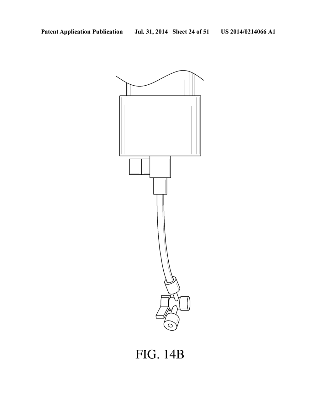 INTRAGASTRIC DEVICE - diagram, schematic, and image 25