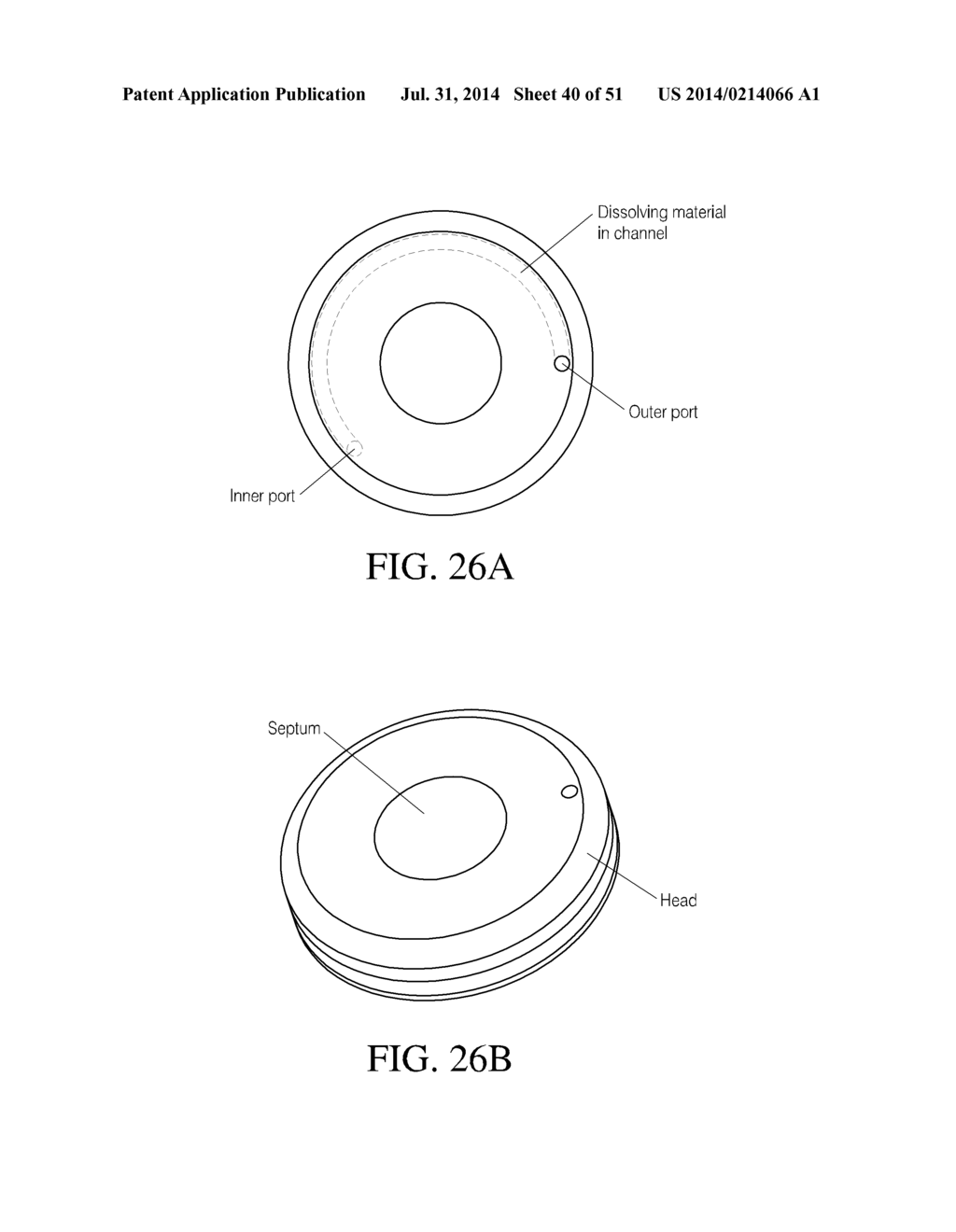 INTRAGASTRIC DEVICE - diagram, schematic, and image 41