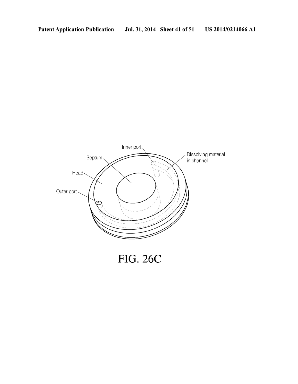 INTRAGASTRIC DEVICE - diagram, schematic, and image 42