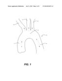 AORTIC GREAT VESSEL PROTECTION diagram and image