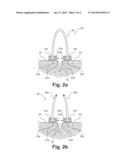 Magnetic Wound Closure Assembly and Method of Use diagram and image