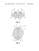 Magnetic Wound Closure Assembly and Method of Use diagram and image