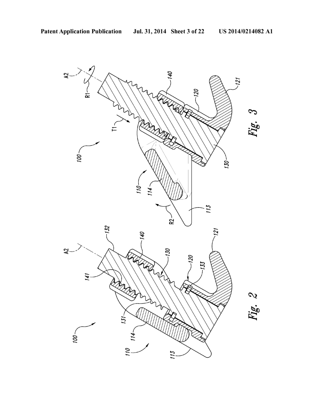 SPINAL SPACER FOR CERVICAL AND OTHER VERTEBRA, AND ASSOCIATED SYSTEMS AND     METHODS - diagram, schematic, and image 04