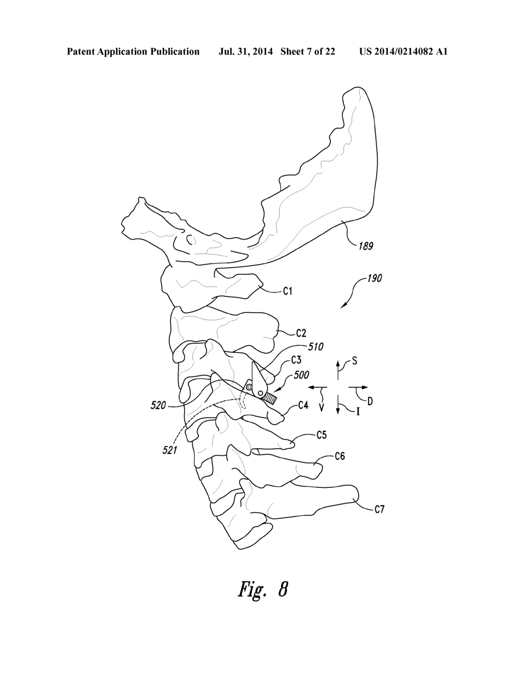 SPINAL SPACER FOR CERVICAL AND OTHER VERTEBRA, AND ASSOCIATED SYSTEMS AND     METHODS - diagram, schematic, and image 08