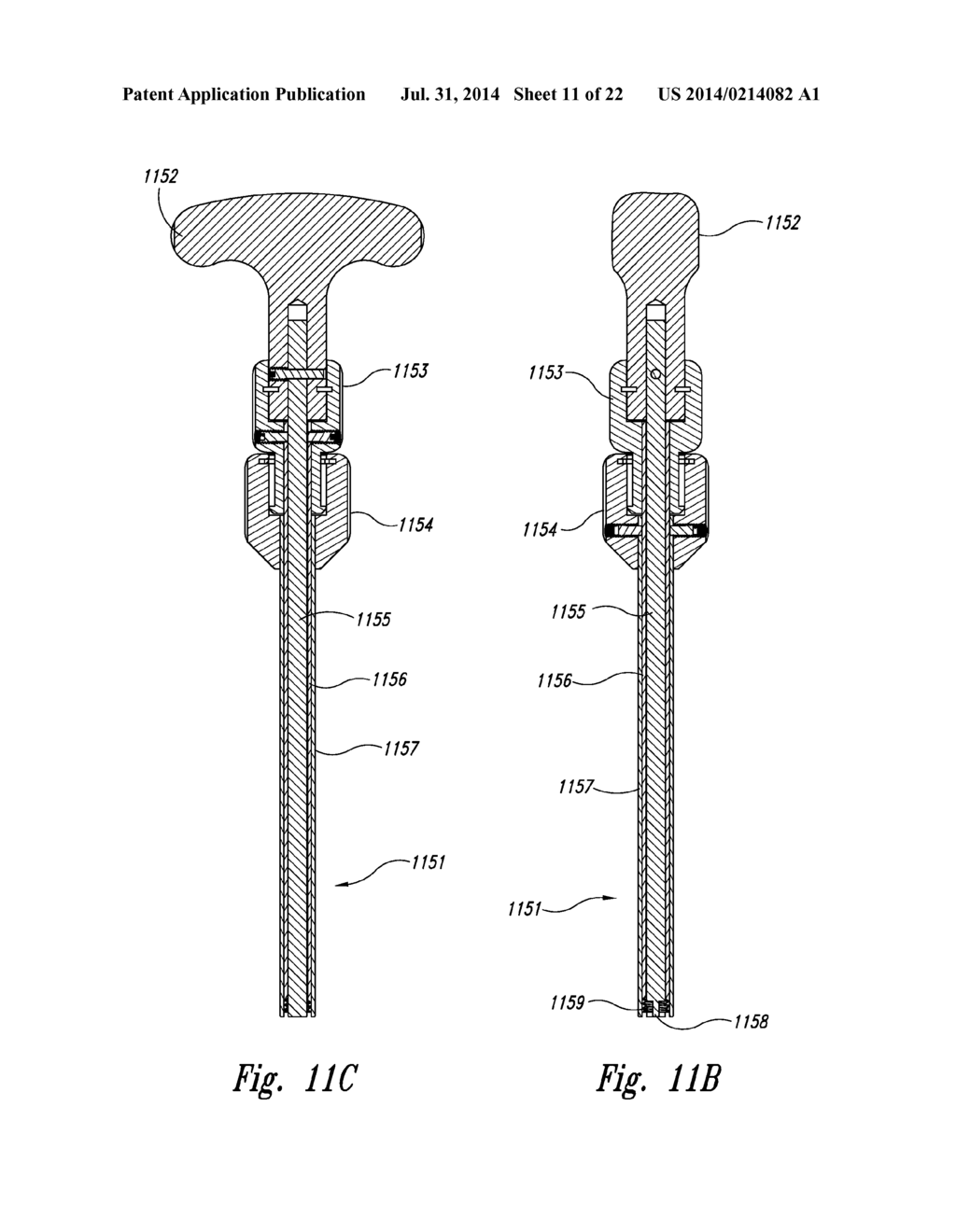 SPINAL SPACER FOR CERVICAL AND OTHER VERTEBRA, AND ASSOCIATED SYSTEMS AND     METHODS - diagram, schematic, and image 12