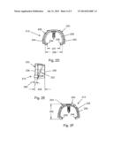 JOINT ALIGNER IMPLANT diagram and image