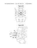 ORTHOPAEDIC PLATE diagram and image