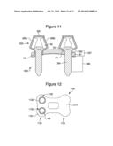 ORTHOPAEDIC PLATE diagram and image