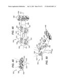 Disposable Orthopedic Surgery Kit And Components diagram and image