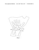 SYSTEMS AND DEVICES FOR THE REDUCTION AND ASSOCIATION OF BONES diagram and image