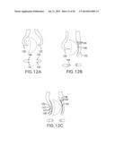 SYSTEMS AND DEVICES FOR THE REDUCTION AND ASSOCIATION OF BONES diagram and image