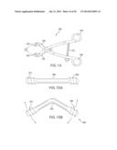 SYSTEMS AND DEVICES FOR THE REDUCTION AND ASSOCIATION OF BONES diagram and image