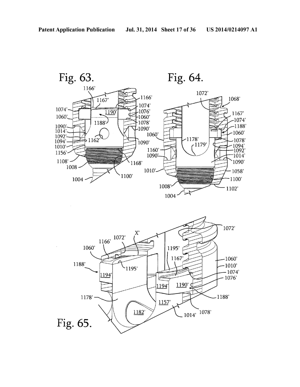 DUAL MEDICAL IMPLANT CLOSURE DRIVE SYSTEM - diagram, schematic, and image 18