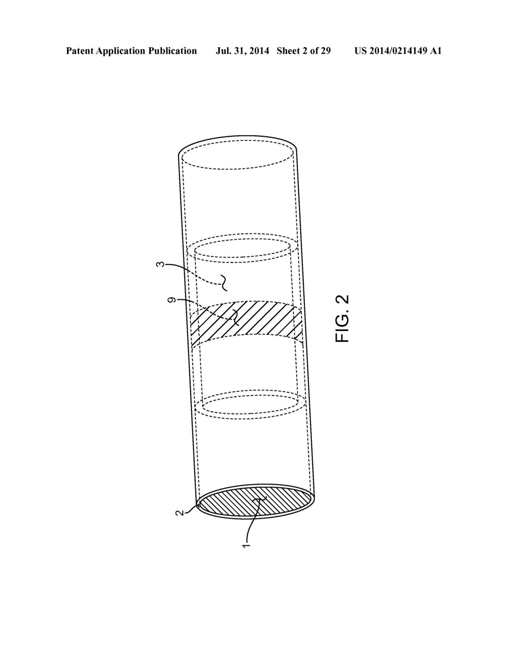 METHOD AND APPARATUS FOR MEASURING FLOW THROUGH A LUMEN - diagram, schematic, and image 03