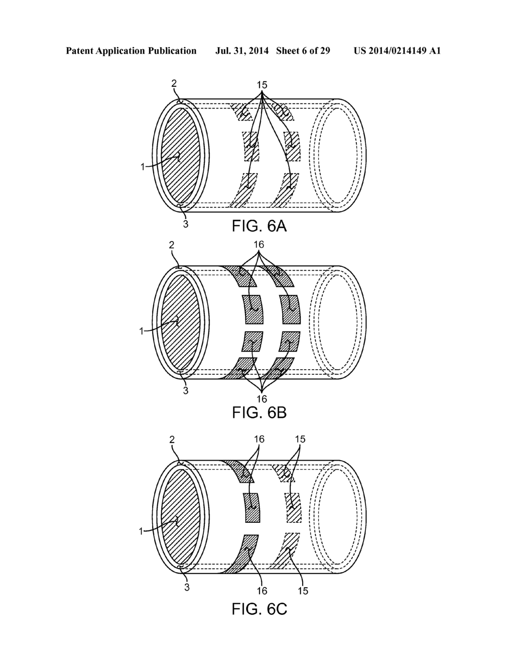 METHOD AND APPARATUS FOR MEASURING FLOW THROUGH A LUMEN - diagram, schematic, and image 07