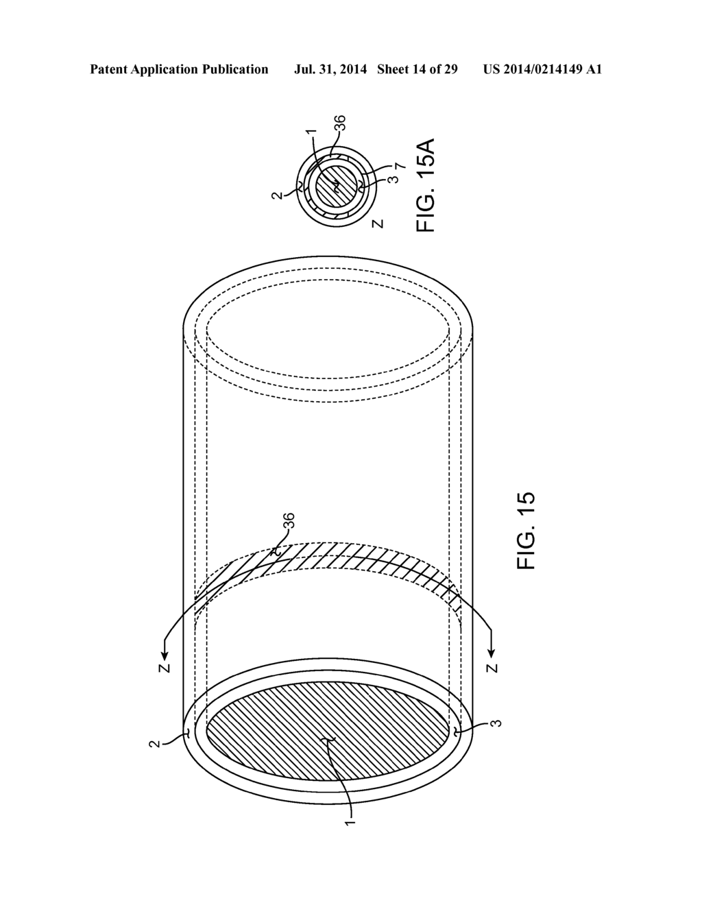 METHOD AND APPARATUS FOR MEASURING FLOW THROUGH A LUMEN - diagram, schematic, and image 15