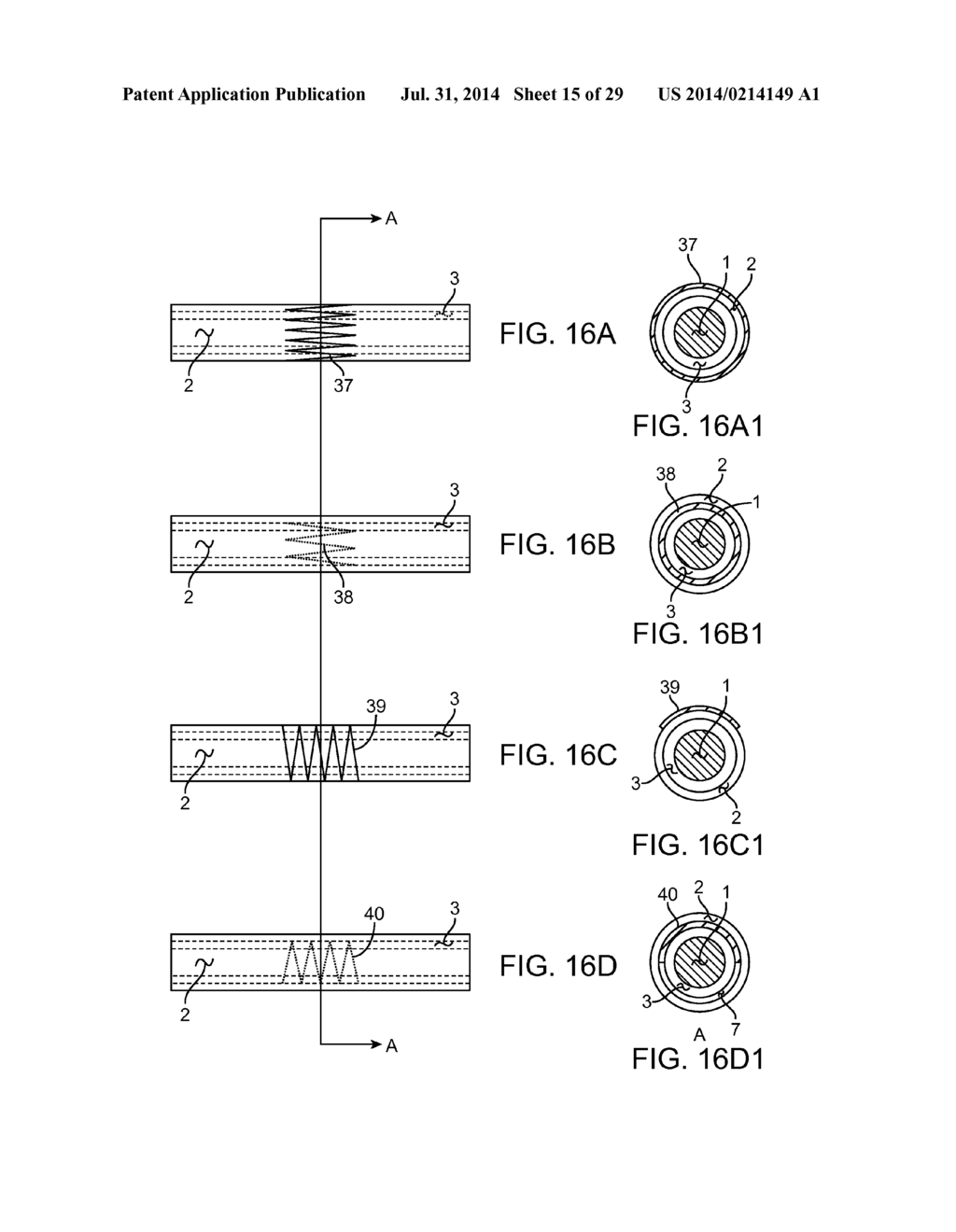 METHOD AND APPARATUS FOR MEASURING FLOW THROUGH A LUMEN - diagram, schematic, and image 16